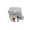 Ferritin ELISA